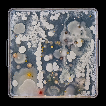Microbes Swabbed from a Palette Used by Lawren Harris
